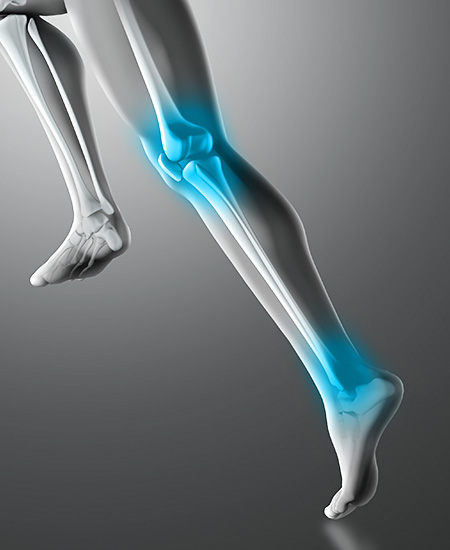 ön çapraz bağ tedavisi