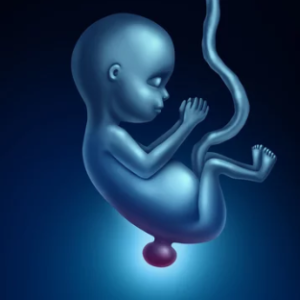 Spina Bifida Nedenleri