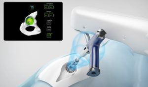 robotik kalça protez