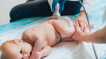 Kalça Çıkığı Belirtileri