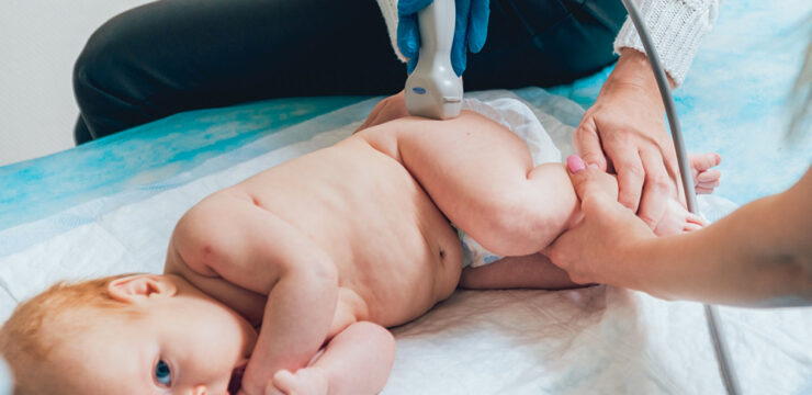 Kalça Çıkığı Belirtileri