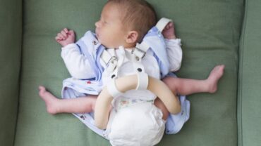 Kalça Çıkığı Tedavisi