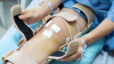 Diz Protezi Ameliyatı Nedir?