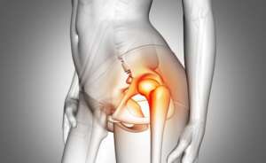 Total Kalça Protezi Ameliyatı