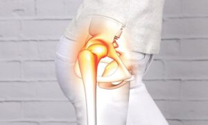 Kalça Çıkığı Ameliyatı Nasıl Yapılır