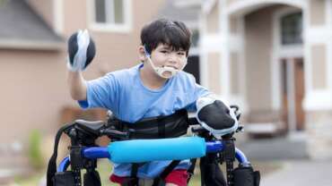 Diskinetik Serebral Palsi Nedir