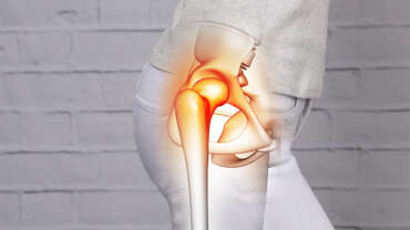 Kalçada Çıkık Belirtileri