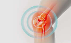 Ön Çapraz Bağ Ameliyatı Sonrası