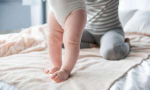 Bebeklerde Kalça Çıkığı